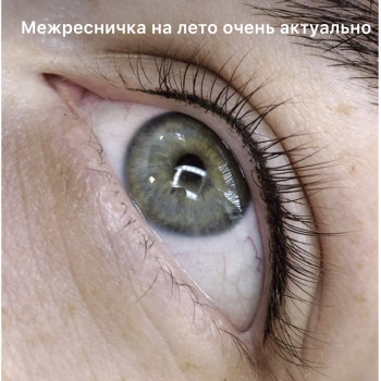 Межресничка