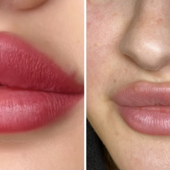 Губы после процедуры ПМ / после зажившие