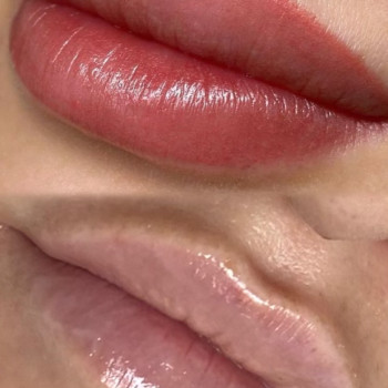 Губы до / после ПМ