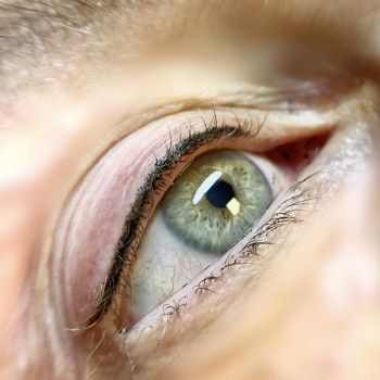 Межресничка на возрастной коже 60 +