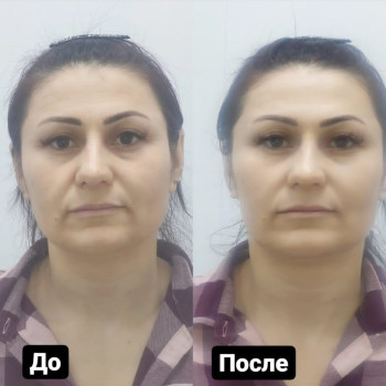 Maxim Pasichnichenko, Khabarovsk Фото - 19