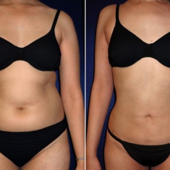 Maxim Pasichnichenko, Khabarovsk Фото - 21