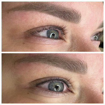 Заполнение межресничного пространства