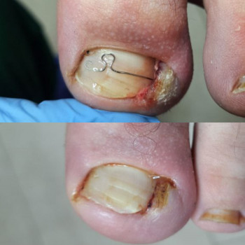 Olena Koval, Warszawa Фото - 8