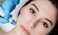 Hydro peeling (hydro dermabrasion). Гидропилинг (гидродермабразия). Гідропілінг (гідродермабразія) Косметолог-эстетист Iuliia Sokolova Уэст Палм Бич