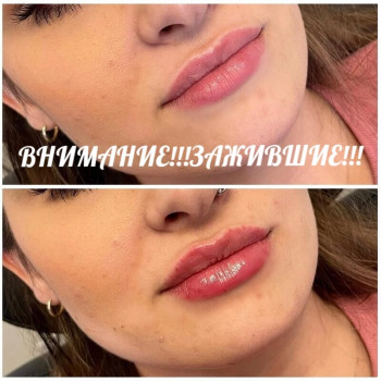 Контурная пластика губ
                    Kosmetyczka Natalia Sambur Omsk