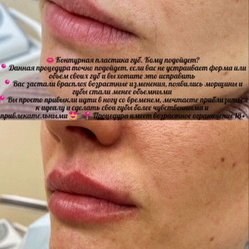 Контурная пластика губ
                    Kosmetyczka Natalia Sambur Omsk