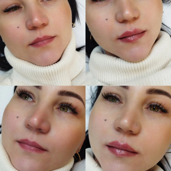 Контурная пластика губ
                    Kosmetyczka Natalia Sambur Omsk