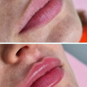 Контурная пластика губ
                    Kosmetyczka Natalia Sambur Omsk