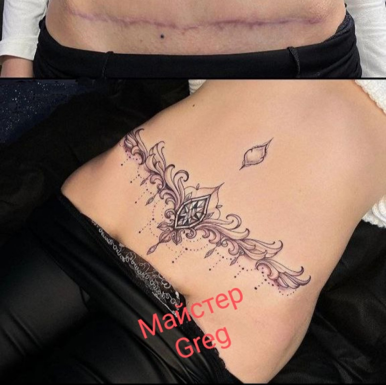  #cover the scar #tattooshram #tattoo after surgery #, photo - Tattoo Master Barb Tattoo