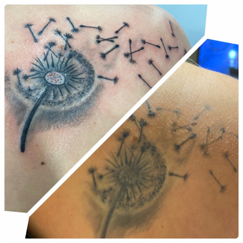 Back dandelion recovery, photo - Tattoo Master Barb Tattoo