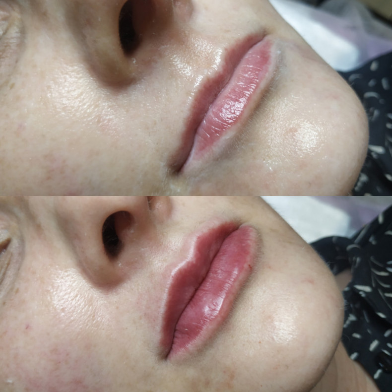 Natürliche Lippen #Lippenvergrößerung #Lippenfeuchtigkeit #Lippenkonturierung #Lippen, photo - Tattoo-Meister Barb Tattoo