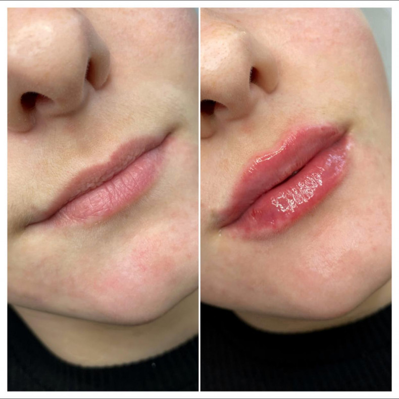 Lippenkonturierung #Lippen #Lippenstifte #Lippenvergrößerung #Lippen, photo - Tattoo-Meister Barb Tattoo