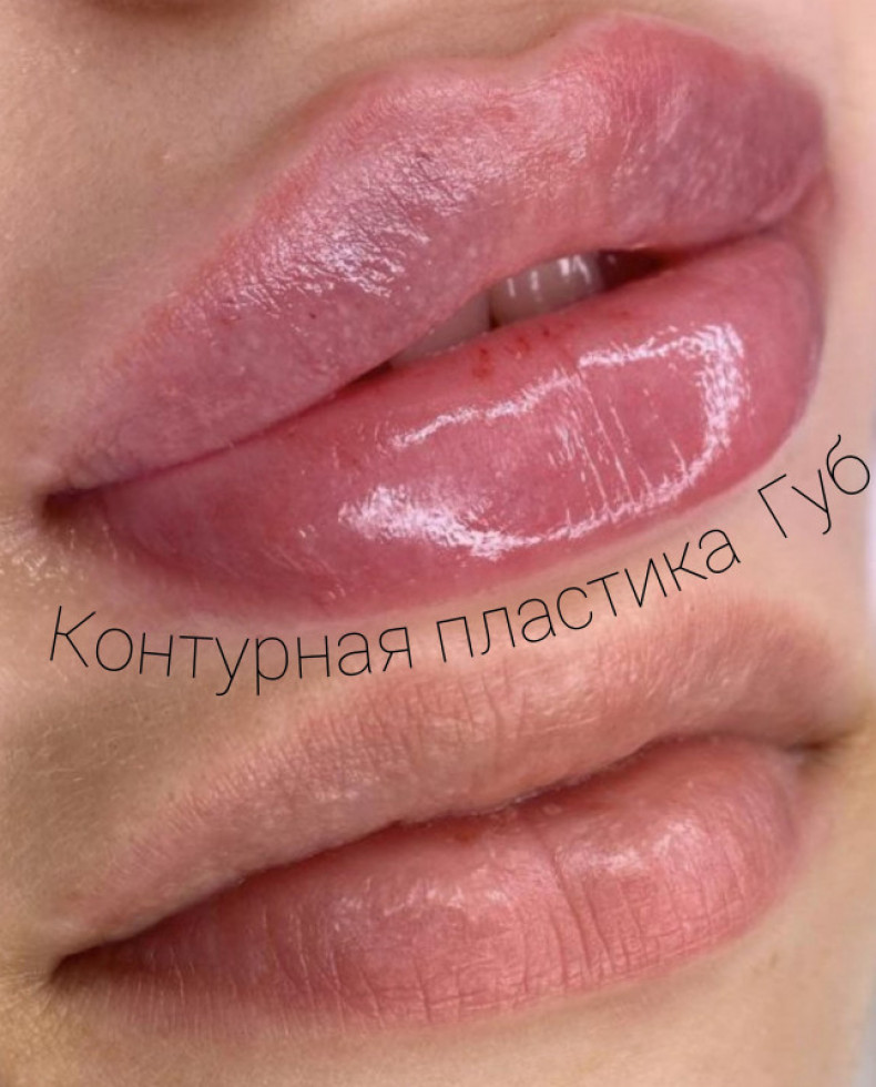  #збольшениегуб #увеличениегуб #губыпокровск #губы #Контурнаяпластика #косметолог #permanent, photo - Tattoo Master Barb Tattoo