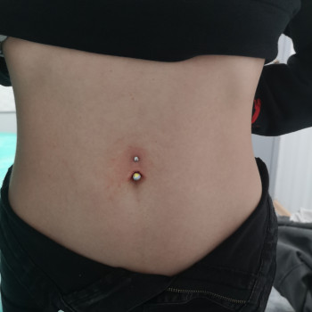 Пирсинг пупок
                    Косметолог-инъекционист Наталия Герасимюк Краков