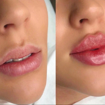 Cloud Beauty, Москва Фото - 6