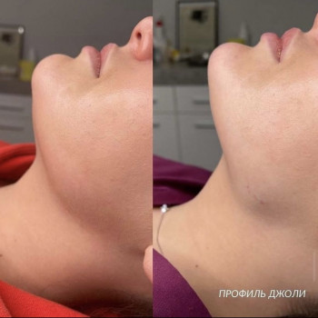 Cloud Beauty, Москва Фото - 9