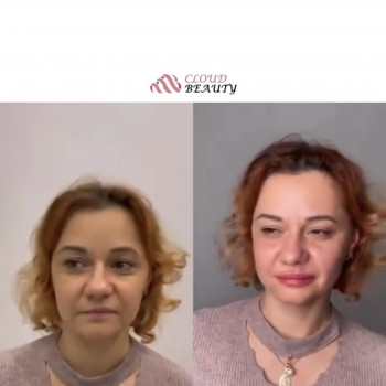 Cloud Beauty, Москва Фото - 11