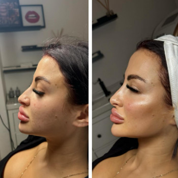 Svetlana Tsybulska, Berlin Фото - 6