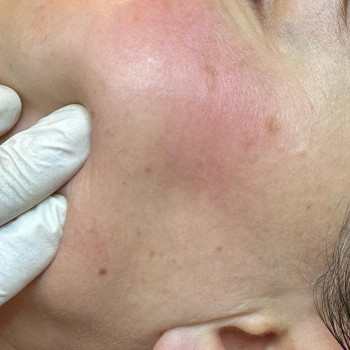 Svetlana Gerts, Berlin Фото - 5