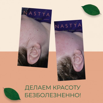 Шугаринг рук до локтя