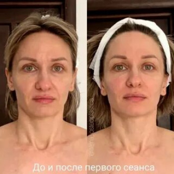 Массаж лица. Эстетическая косметология.
                    Массажист Светлана Митина Саратов