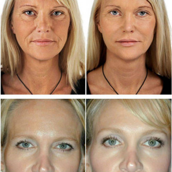 Массаж лица. Эстетическая косметология.
                    Массажист Светлана Митина Саратов