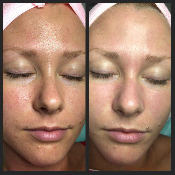 Массаж лица. Эстетическая косметология.
                    Массажист Светлана Митина Саратов