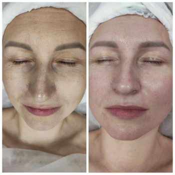 Массаж лица. Эстетическая косметология.
                    Массажист Светлана Митина Саратов