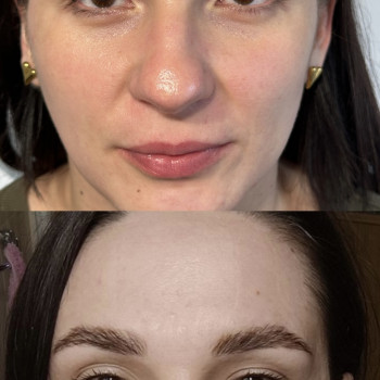 Результат коррекции лица