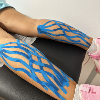 Эстетичнское тейпирование тела
                    Kinezjoterapeuta Viktoria Tsiutava Warszawa