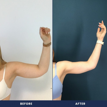 Med-Plast, Berlin Фото - 5