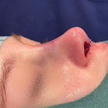 Dilan Arsoy, Berlin Фото - 5