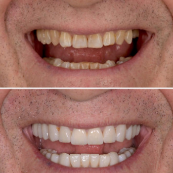 Александр Вайсберг, Берлин Фото - 5