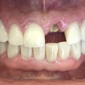 Александр Вайсберг, Берлин Фото - 6