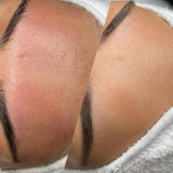 House of Skin, Бохум Фото - 5