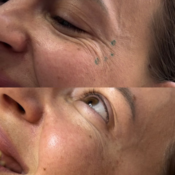 Alina Rudska, Wrocław Фото - 7