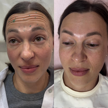 Alina Rudska, Wrocław Фото - 9