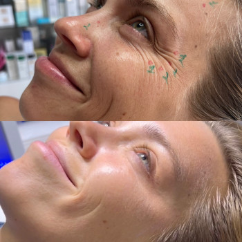 Alina Rudska, Wrocław Фото - 10