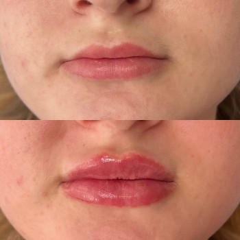 Alina Rudska, Wrocław Фото - 11