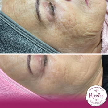 Nicoles Binger, Bochum Фото - 5