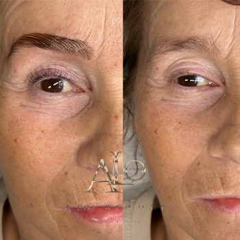 A.Lo Beauty, Bochum Фото - 5