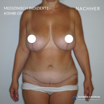 Ästhetik-Centrum, Bochum Фото - 7