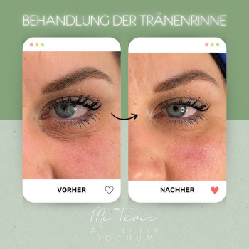 Nele Abel, Bochum Фото - 5