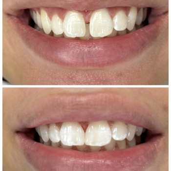 Zahnärzte, Bochum Фото - 5