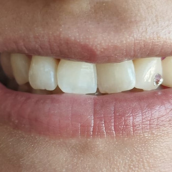 Alexander Mutschler, Bochum Фото - 5