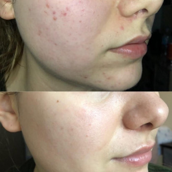 Esmerella, Braunschweig Фото - 5