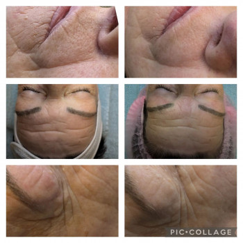 Yvonne Wellecke, Braunschweig Фото - 5