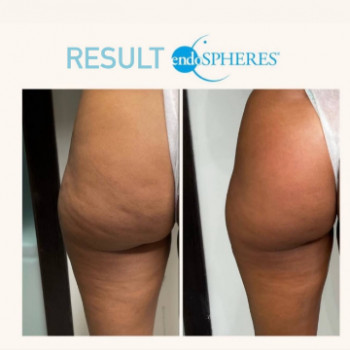 Kior, Munich Фото - 5