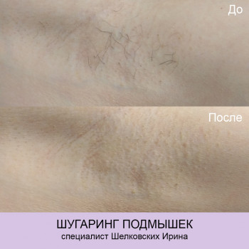 Epilcity, Moscow Фото - 9